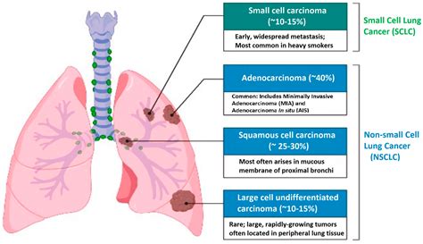 nsclc loan